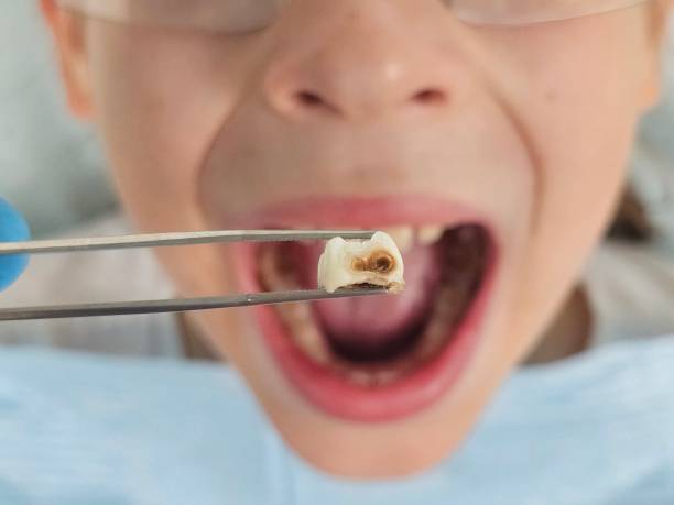 Best Emergency Treatment for Toothache in Necedah, WI